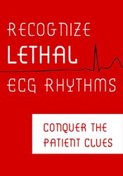 Robin Gilbert - Recognize Lethal ECG Rhythms - Conquer the Patient Clues